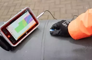 Ultrasound Equipment: Principles, Functions, and Clinical Applications