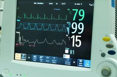 Electrocardiographic Monitors: What They Are, How They Work, and What the Evidence Shows