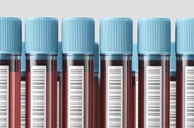 Direct-to-Consumer Blood Testing: Empowerment or Peril?