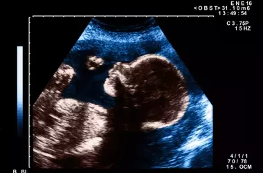 The Art and Impact of Pregnancy Nicknames